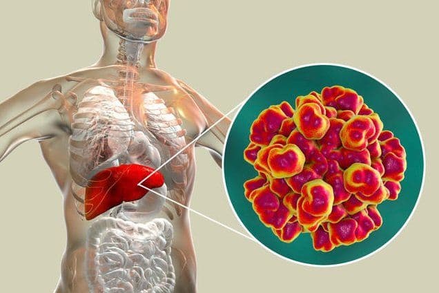 Can Hepatitis C be Treated?