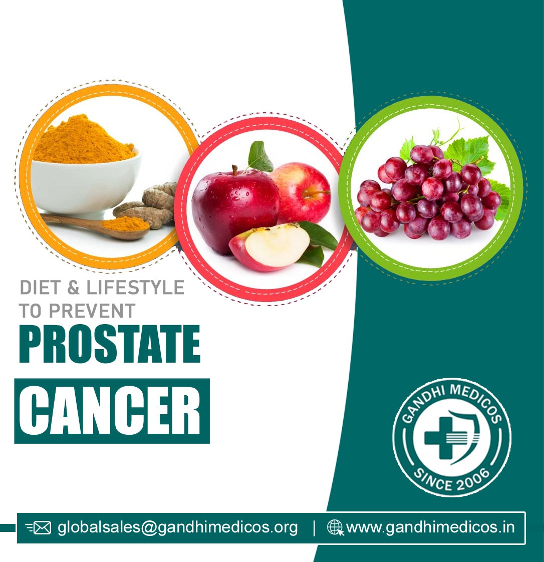  Diet to prevent prostate cancer 